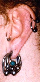 Stretched ear