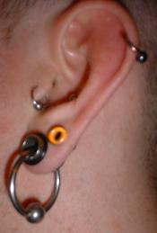 Stretched ear
